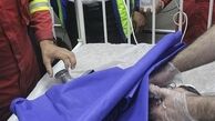 له شدن دست کودک 2 ساله در چرخ گوشت + تصاوی