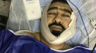 آخرین وضعیت "طلبه‌ تهرانی" که با ضربات قمه یک اوباش مجروح شد / عکس