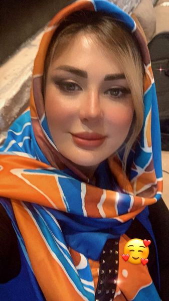 تغییر چهره نیوشا ضیغمی بعد از عمل جراحی + عکس