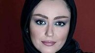 تغییر چهره «شقایق فراهانی» /عکس