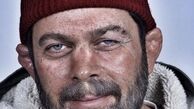 گوش شکسته پژمان بازغی + عکس