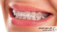 در دوران کرونا چطور به دانپزشکی مراجعه کنیم