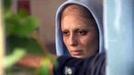 نیوشا ضیغمی بعد از شیمی درمانی+عکس