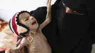 یمن و سه کشور آفریقایی در معرض تهدید گرسنگی