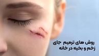 ۹ روش ترمیم جای زخم و بخیه در خانه