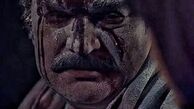 صورت زخمی مهدی سلطانی + عکس