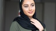 چهره خونین خانم بازیگر در اینستاگرام+عکس