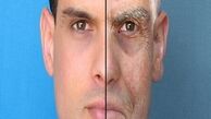 رژیم لاغری سخت، پوست را شل می‌کند