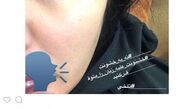 حمله فیزیکی به بازیگر زن ایرانی +عکس