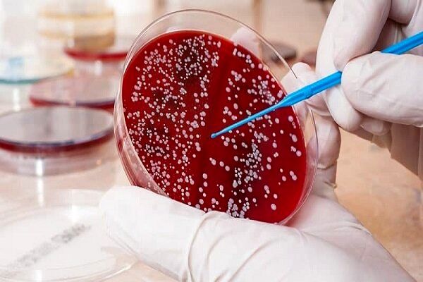 آیا تعریق شبانه از علائم سرطان خون است ؟