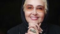 چهره متحول شده خانم بازیگر ایرانی + عکس