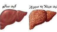 علل مهم و عمده ی ایجاد سیروز کبدی چیست؟