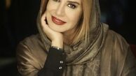 تغییر چهره نسیم ادبی + عکس