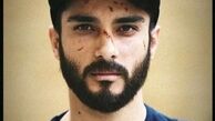 صورت داغون شده ساعد سهیلی + عکس