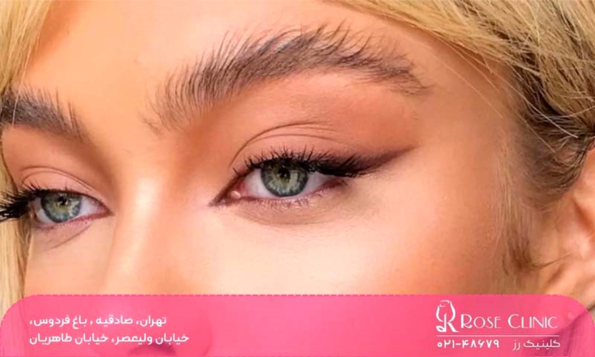 علت سیخ شدن ابرو بعد از کاشت​ چیست؟