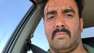 ماشین سواری پوریا پورسرخ با ظاهر کتک خورده+عکس