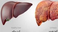 درمان کبد چرب با استفاده از طب سنتی