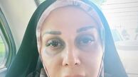 گریم متفاوتی از شیوا خسرومهر در دادستان + عکس