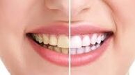 ابتلا به این بیماری‌ها باعث بد‌بویی دهان می‌شوند