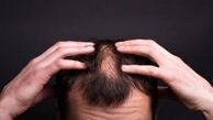 تاثیرات بی خوابی بر روی زیبایی و سلامت مو