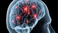 هنگام بروز سکته مغزی چه باید کرد؟ 
