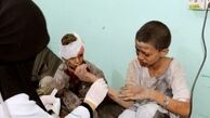 400 هزار کودک یمنی به دلیل سوء تغذیه با مرگ فاصله‌ای ندارند
